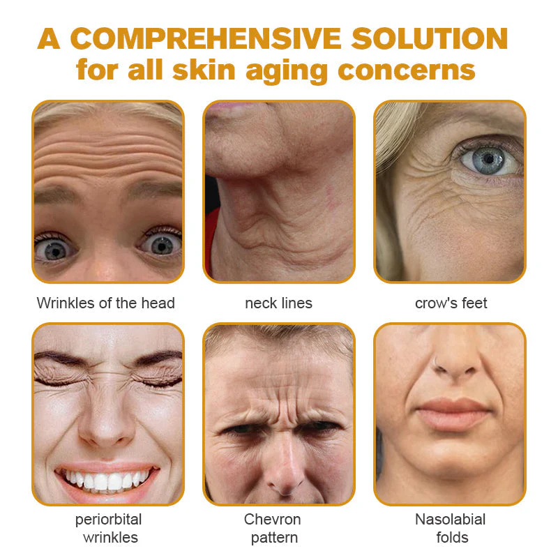 👨‍⚕️ Made and Shipped from US✅ Botox Bee Venom Wrinkle Removal Cream- LAST DAY 80% OFF