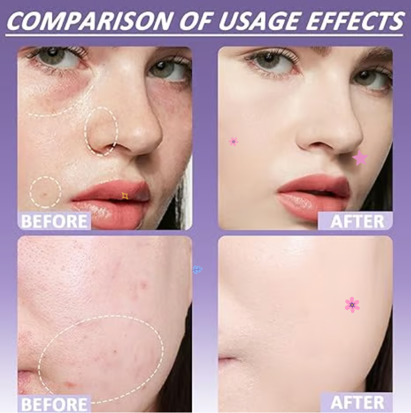 🔥Soft Matte Cream Concealer