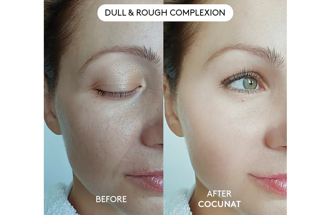 This Is How Thousands of Women Are Getting Rid of Their Wrinkles ✨