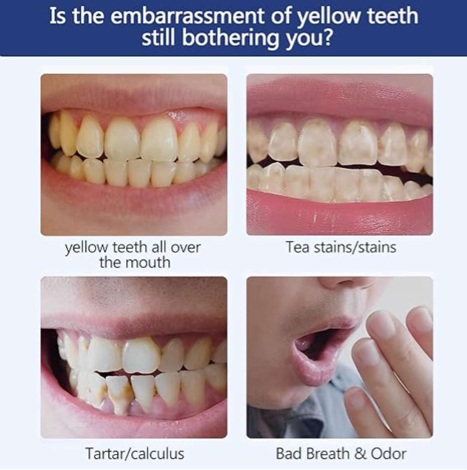Teeth Whitening Powder - 50g Probiotics Tooth Powder