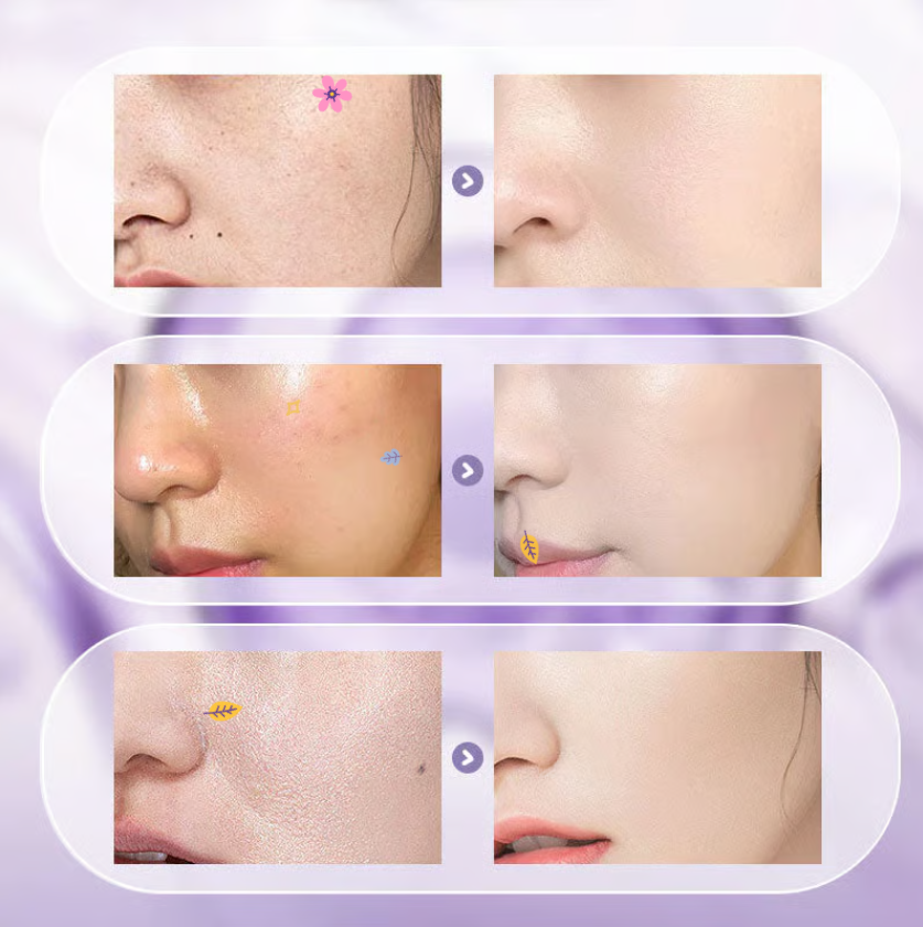 🎉 New Upgrade🎉All-in-One Niacinamide Cream