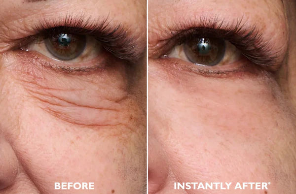 LumiLift Instant Tightener