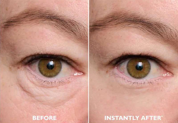 LumiLift Instant Tightener