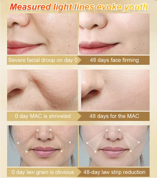 Anti-Wrinkle Firming Serum 🔥Buy 2 Get 1 Free🔥 (Free Shipping)