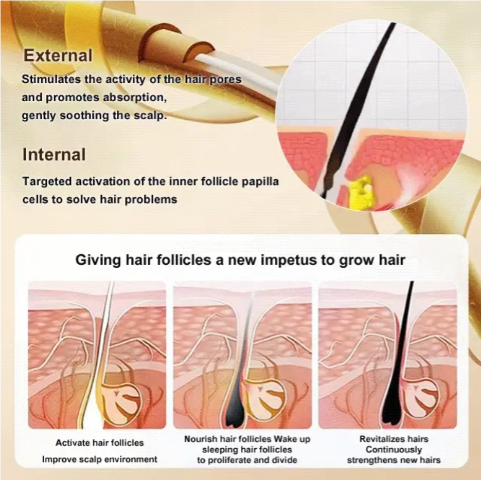 ANTI-HAIR LOSS AND HAIR GROWTH SOLUTION