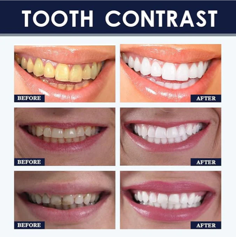 Teeth Whitening Powder - 50g Probiotics Tooth Powder