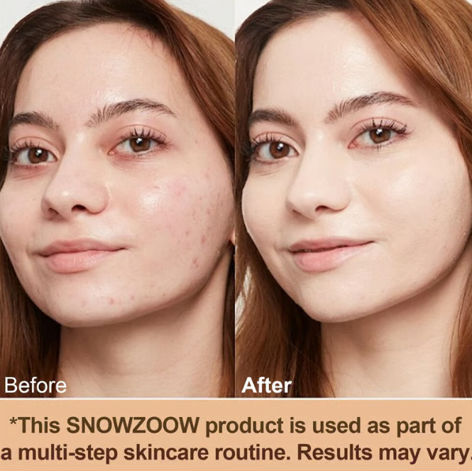 💖 Achieve Flawless Skin ✨Foundation 4 in 1 - Light Spectrum