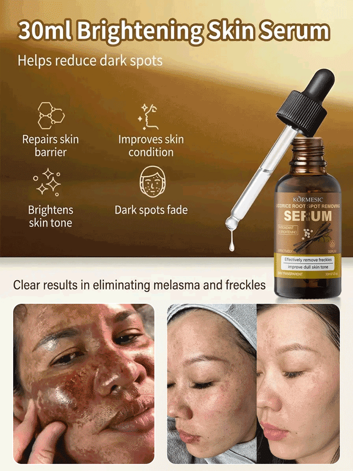 Niacinamide Whitening and Spot-Removing Essence