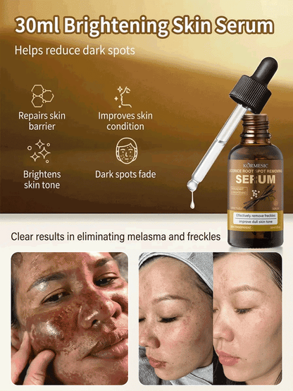 Niacinamide Whitening and Spot-Removing Essence