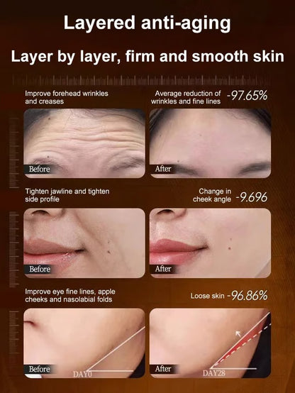 🏆Flash Sale⚡Micro-Molecular Collagen Anti-Wrinkle Lotion