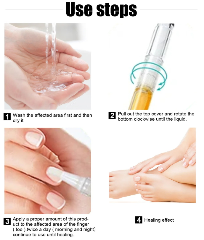 Anti-Fungal Pen – Gets Rid Of Even the Most Stubborn Nail Fungus