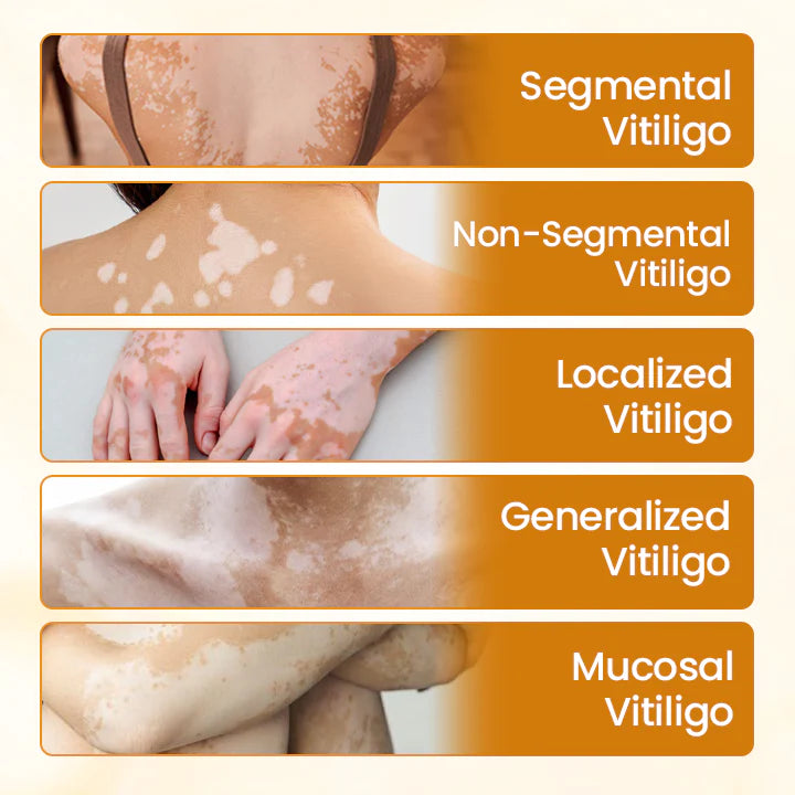 Oveallgo® VitiClear Pro Bee Venom Cream