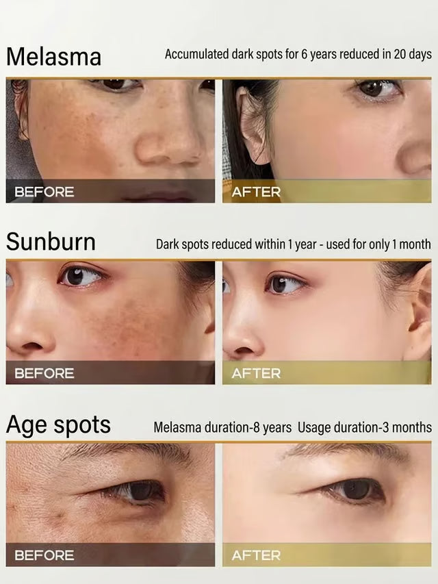 Niacinamide Whitening and Spot-Removing Essence
