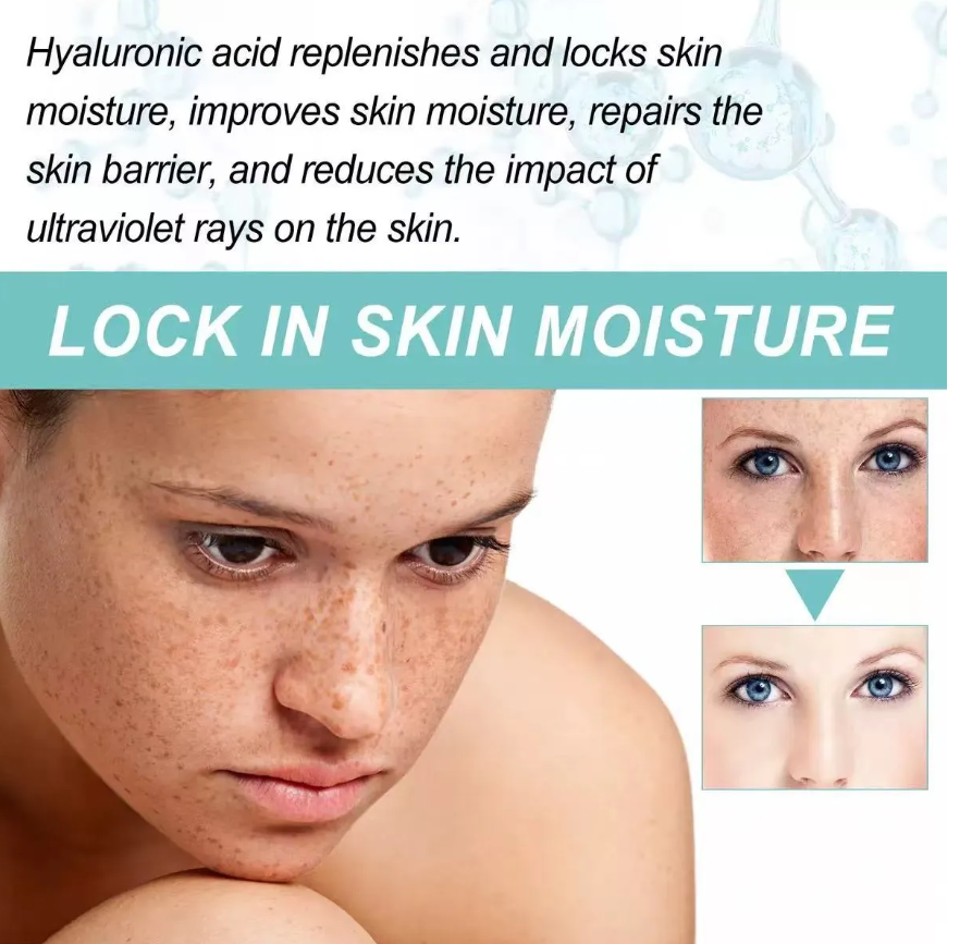 Dark Spot Corrector-Special Cream For Melasma Treatment