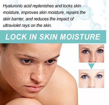 Dark Spot Corrector-Special Cream For Melasma Treatment