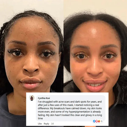 🏆Pamper Yourself — Buy 2 Collagen Night Masks, Get 1 Free! Wake Up to Youthful, Hydrated Skin!